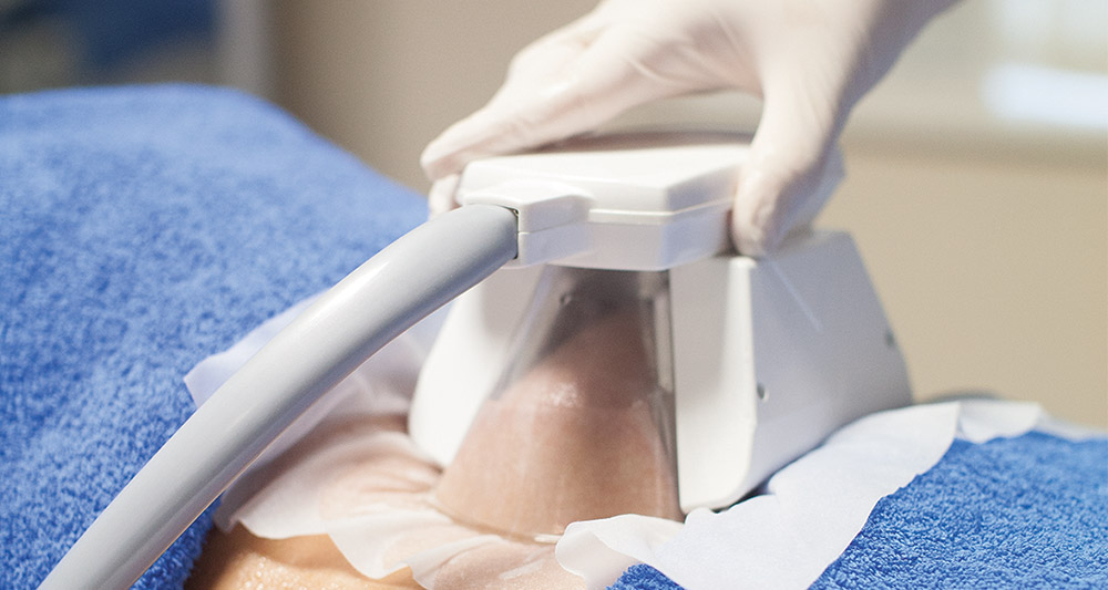 How Fat Freezing and HIFU Work Together? 2 Multiple Areas in One Session HIFU and Fat Freezing Stanford-le-Hope