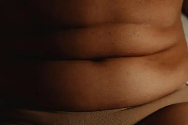 The Hidden Connection: How Stress Shapes Your Fitness and Body Composition 3 image of what stress can do on the stomach area and how Lipo 360 Stanford-le-Hope can help to change your body shape.