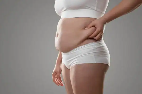Image of stress belly Stanford-le-Hope How Lipo 360 can help manage your symptoms